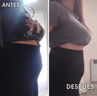 Ana - antes y después