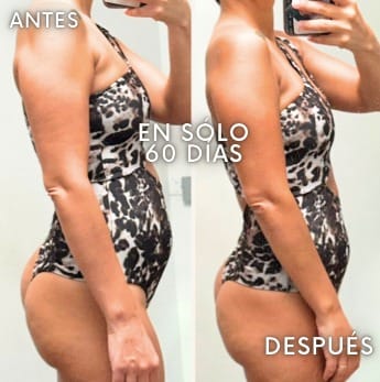 Betiana - antes y después