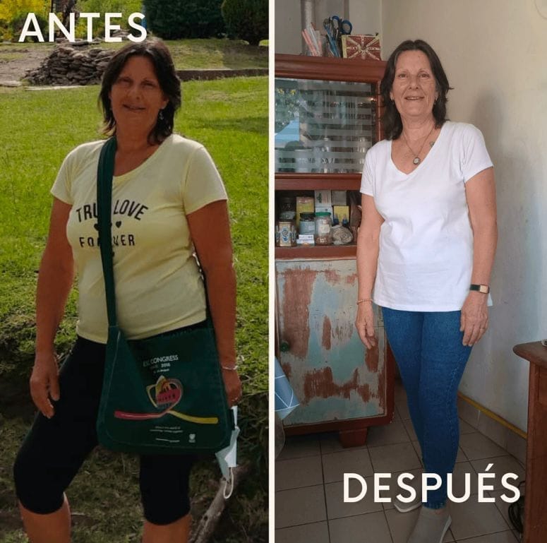 Patricia - antes y después