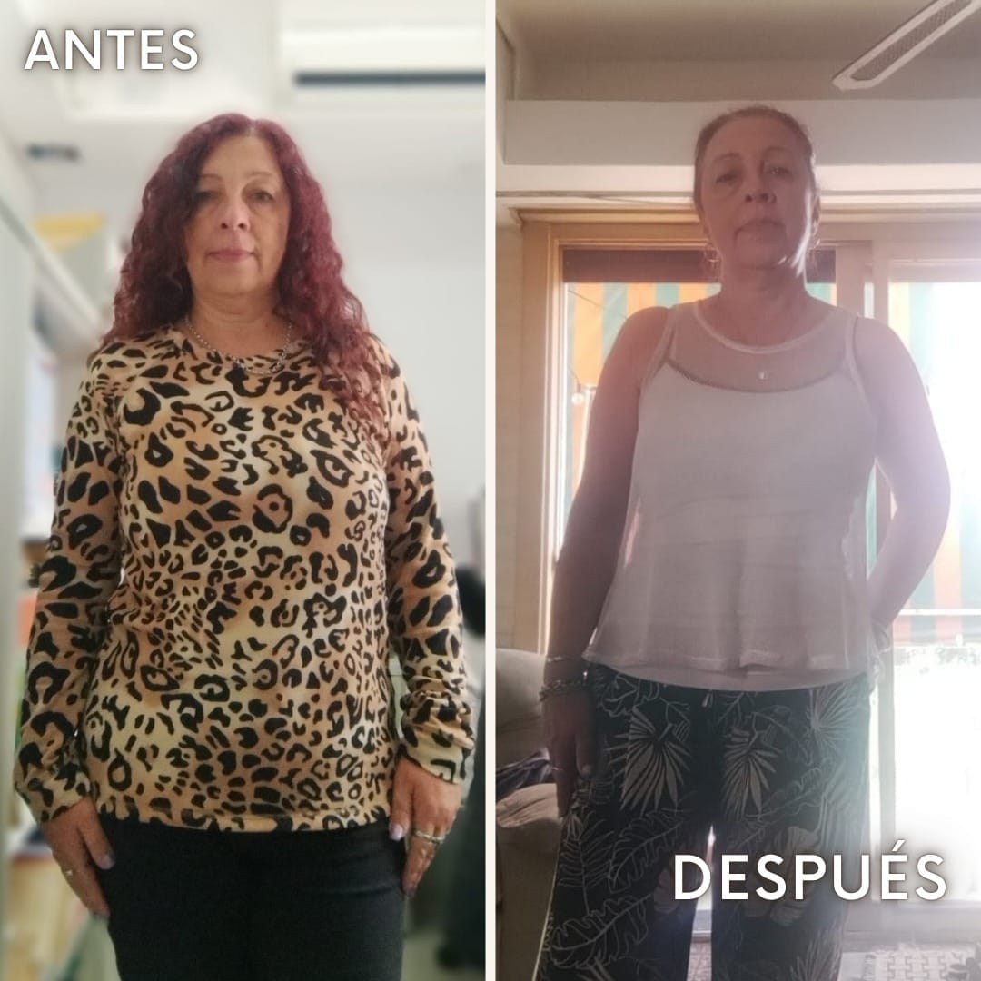 Patricia - antes y después